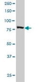 Monoclonal Anti-STAT3 antibody produced in mouse clone 4D6, purified immunoglobulin, buffered aqueous solution