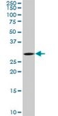 ANTI-TGIF2 antibody produced in mouse clone 5G1, purified immunoglobulin, buffered aqueous solution