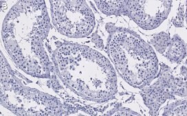 Anti-HDAC2 Antibody, clone 1E22 ZooMAb® Rabbit Monoclonal recombinant, expressed in HEK 293 cells