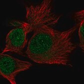 Anti-C15orf65 antibody produced in rabbit Prestige Antibodies&#174; Powered by Atlas Antibodies, affinity isolated antibody, buffered aqueous glycerol solution