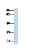 Anti-TP73 antibody produced in rabbit affinity isolated antibody