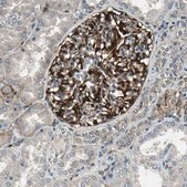 ANTI-EXD2 antibody produced in rabbit Ab2, Prestige Antibodies&#174; Powered by Atlas Antibodies, affinity isolated antibody, buffered aqueous glycerol solution