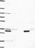 Anti-HNMT antibody produced in rabbit Prestige Antibodies&#174; Powered by Atlas Antibodies, affinity isolated antibody, buffered aqueous glycerol solution