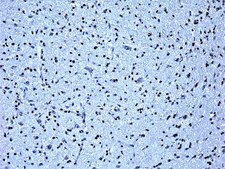抗-寡糖-2 抗体 from rabbit, purified by affinity chromatography