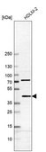 Anti-B4GALT7 antibody produced in rabbit Prestige Antibodies® Powered by Atlas Antibodies, affinity isolated antibody, buffered aqueous glycerol solution