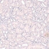 Monoclonal Anti-Lag3 Antibody Produced In Mouse Prestige Antibodies® Powered by Atlas Antibodies, clone CL14773, affinity isolated antibody, buffered aqueous glycerol solution