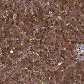 Anti-QPRT antibody produced in rabbit Prestige Antibodies&#174; Powered by Atlas Antibodies, affinity isolated antibody, buffered aqueous glycerol solution