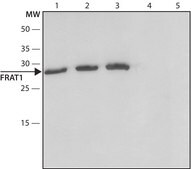 Anti-FRAT1 antibody produced in rabbit ~1.5 mg/mL, affinity isolated antibody, buffered aqueous solution