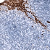 Monoclonal Anti-S100A9 antibody produced in mouse Prestige Antibodies® Powered by Atlas Antibodies, clone CL11191, purified antibody (Protein A)