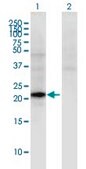 Monoclonal Anti-CGB5 antibody produced in mouse clone 2E7, purified immunoglobulin, buffered aqueous solution