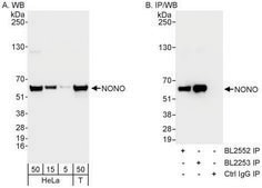 Rabbit anti-NONO Antibody, Affinity Purified Powered by Bethyl Laboratories, Inc.