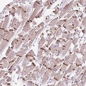 Anti-DSP antibody produced in rabbit Prestige Antibodies&#174; Powered by Atlas Antibodies, affinity isolated antibody, buffered aqueous glycerol solution
