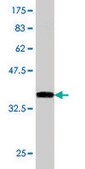Monoclonal Anti-FUSIP1, (N-terminal) antibody produced in mouse clone 1G11, purified immunoglobulin, buffered aqueous solution