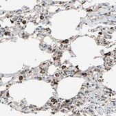 Anti-ZNF608 antibody produced in rabbit Prestige Antibodies&#174; Powered by Atlas Antibodies, affinity isolated antibody, buffered aqueous glycerol solution