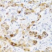 Anti-Fibronectin antibody produced in rabbit