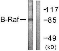 Anti-B-RAF, C-Terminal antibody produced in rabbit affinity isolated antibody
