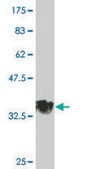 Monoclonal Anti-MGC26963 antibody produced in mouse clone 7D10, purified immunoglobulin, buffered aqueous solution