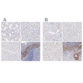 Anti-LAX1 antibody produced in rabbit Ab1, Prestige Antibodies&#174; Powered by Atlas Antibodies, affinity isolated antibody, buffered aqueous glycerol solution