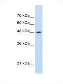 Anti-SMARCE1 antibody produced in rabbit affinity isolated antibody