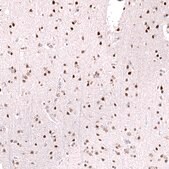 Monoclonal Anti-Foxo3 Antibody Produced In Mouse Prestige Antibodies® Powered by Atlas Antibodies, clone CL13603, affinity isolated antibody, buffered aqueous glycerol solution