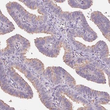 Anti-EMC6 antibody produced in rabbit Prestige Antibodies&#174; Powered by Atlas Antibodies, affinity isolated antibody, buffered aqueous glycerol solution