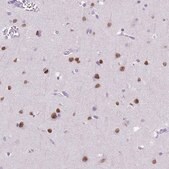 Monoclonal Anti-SATB2 antibody produced in mouse Prestige Antibodies® Powered by Atlas Antibodies, clone CL0321, purified immunoglobulin, buffered aqueous glycerol solution