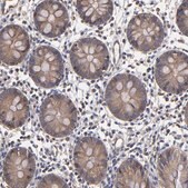 抗-ESYT2 兔抗 Prestige Antibodies&#174; Powered by Atlas Antibodies, affinity isolated antibody, buffered aqueous glycerol solution