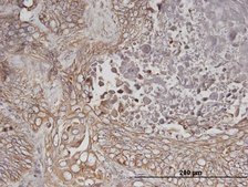 Monoclonal Anti-ERBB3 antibody produced in mouse clone 2E9, purified immunoglobulin, buffered aqueous solution