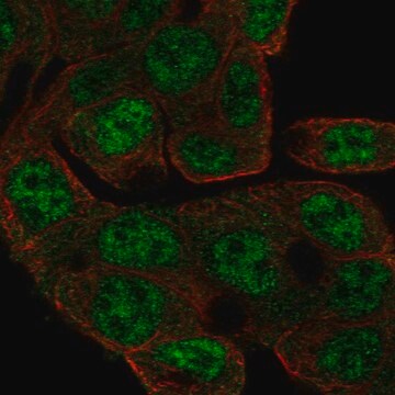 Anti-Ccdc83 Antibody Produced In Rabbit Prestige Antibodies&#174; Powered by Atlas Antibodies, affinity isolated antibody, buffered aqueous glycerol solution