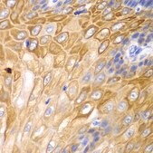 Anti-Cyclin D1 antibody produced in rabbit