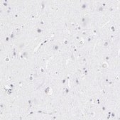 抗-LTBP2 兔抗 affinity isolated antibody, buffered aqueous glycerol solution