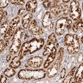 Anti-SUGCT antibody produced in rabbit Prestige Antibodies® Powered by Atlas Antibodies, affinity isolated antibody, buffered aqueous glycerol solution, ab1