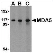 Anti-MDA5 antibody produced in rabbit affinity isolated antibody, buffered aqueous solution