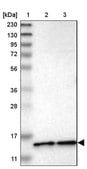 Anti-CDPF1 antibody produced in rabbit Prestige Antibodies® Powered by Atlas Antibodies, affinity isolated antibody, buffered aqueous glycerol solution
