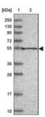 Anti-KCNAB1 antibody produced in rabbit Prestige Antibodies&#174; Powered by Atlas Antibodies, affinity isolated antibody, buffered aqueous glycerol solution