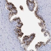 Anti-KLK4 antibody produced in rabbit Prestige Antibodies&#174; Powered by Atlas Antibodies, affinity isolated antibody, buffered aqueous glycerol solution
