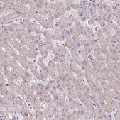 Anti-TMEM178B antibody produced in rabbit Prestige Antibodies® Powered by Atlas Antibodies, affinity isolated antibody, buffered aqueous glycerol solution