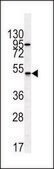 ANTI-GIPR (N-TERM) antibody produced in rabbit IgG fraction of antiserum, buffered aqueous solution