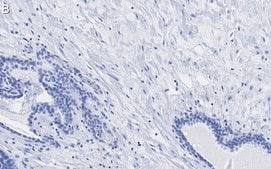 Anti-Integrin beta 1 Antibody, clone HUTS-4 ZooMAb&#174; Mouse Monoclonal recombinant, expressed in HEK 293 cells