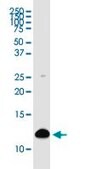Monoclonal Anti-S100A4 antibody produced in mouse clone 1F12-1G7, purified immunoglobulin, buffered aqueous solution
