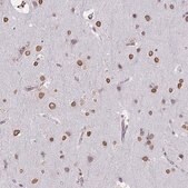 Anti-SEMA6B antibody produced in rabbit Prestige Antibodies&#174; Powered by Atlas Antibodies, affinity isolated antibody, buffered aqueous glycerol solution