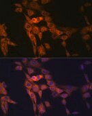 Anti-TWEAKR/Fn14/CD266 Antibody, clone 1G4T3, Rabbit Monoclonal