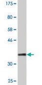 Monoclonal Anti-PYGM antibody produced in mouse clone 2C4, purified immunoglobulin, buffered aqueous solution
