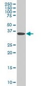 Monoclonal Anti-DCPS antibody produced in mouse clone 3E5, purified immunoglobulin, buffered aqueous solution