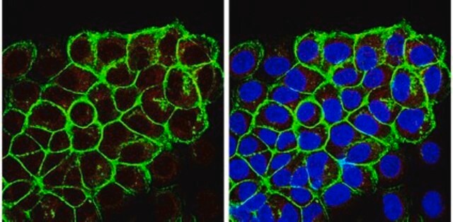 Anti-Ghrelin Antibody, clone 1ML-1D7 ascites fluid, clone 1ML-1D7, from mouse