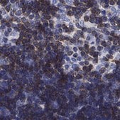 Anti-SEPT1 antibody produced in rabbit Prestige Antibodies® Powered by Atlas Antibodies, affinity isolated antibody, buffered aqueous glycerol solution