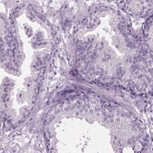 Anti-FAM92B antibody produced in rabbit Prestige Antibodies&#174; Powered by Atlas Antibodies, affinity isolated antibody, buffered aqueous glycerol solution