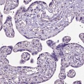 Anti-CFAP54 antibody produced in rabbit Prestige Antibodies® Powered by Atlas Antibodies, affinity isolated antibody, buffered aqueous glycerol solution