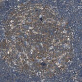 Anti-DDX3X antibody produced in rabbit Prestige Antibodies&#174; Powered by Atlas Antibodies, affinity isolated antibody, buffered aqueous glycerol solution