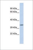 Anti-TEX264 antibody produced in rabbit affinity isolated antibody